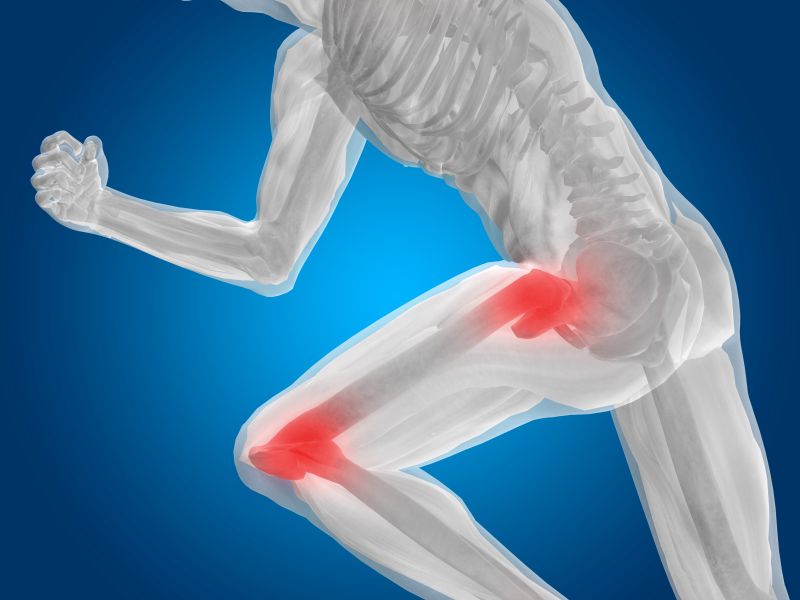 Joint Replacement (Hip & Knee Arthroplasty)